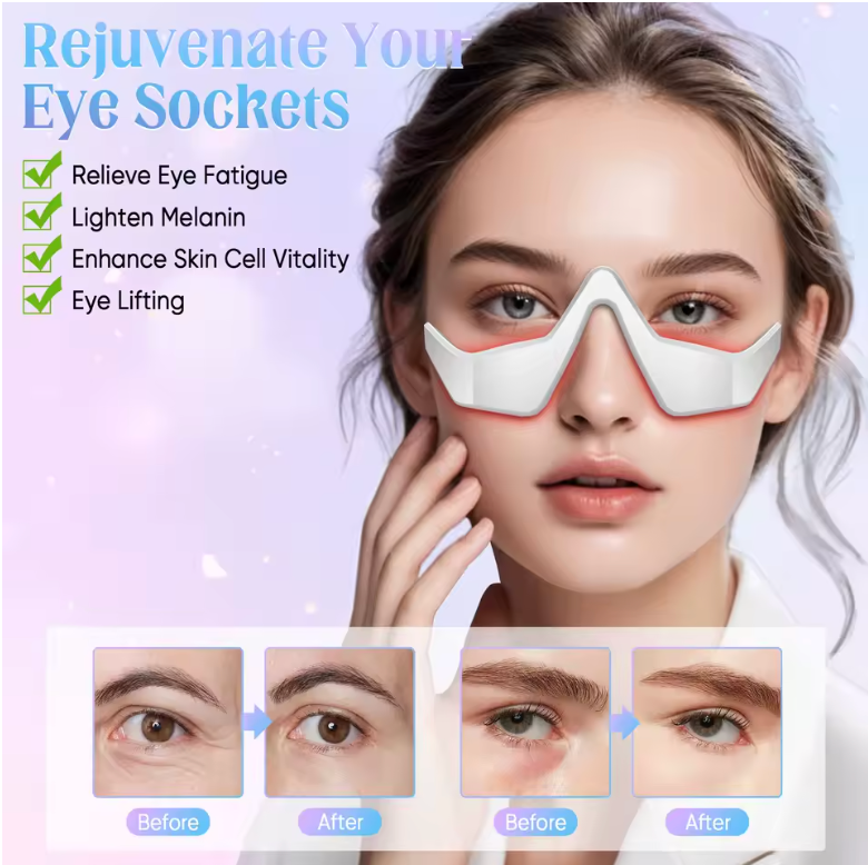 Rotlichttherapiegerät, Mikrostrom-Augenmassagegerät, Rotlicht-Augenmaske gegen Tränensäcke, Augenringe, Schwellungen, Falten und feine Linien